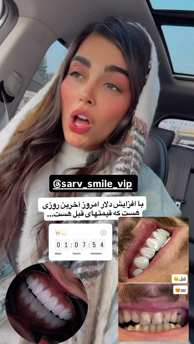  جدید ترین استوری اینستاگرام مهدیس مباشرتی
