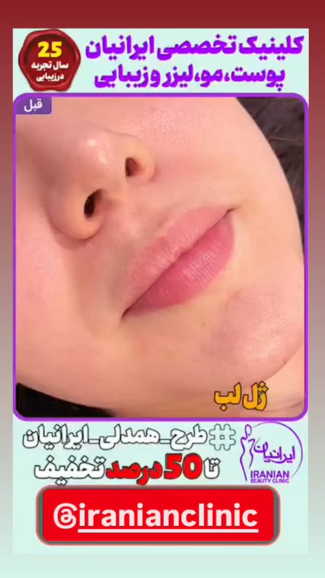  جدید ترین استوری اینستاگرام مهدیار کلائی