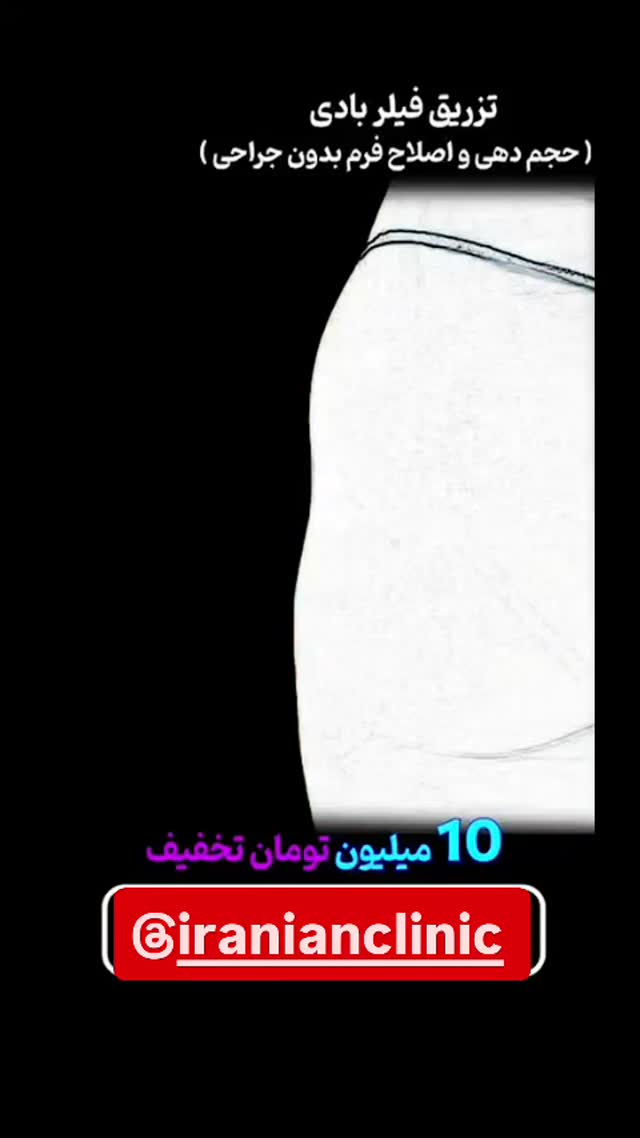  جدید ترین استوری اینستاگرام مهدیار کلائی