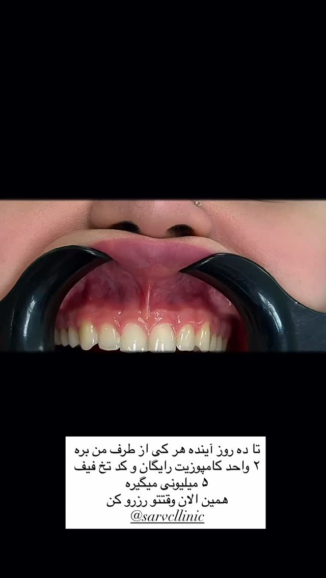  جدید ترین استوری اینستاگرام مهناز اسرافیلی