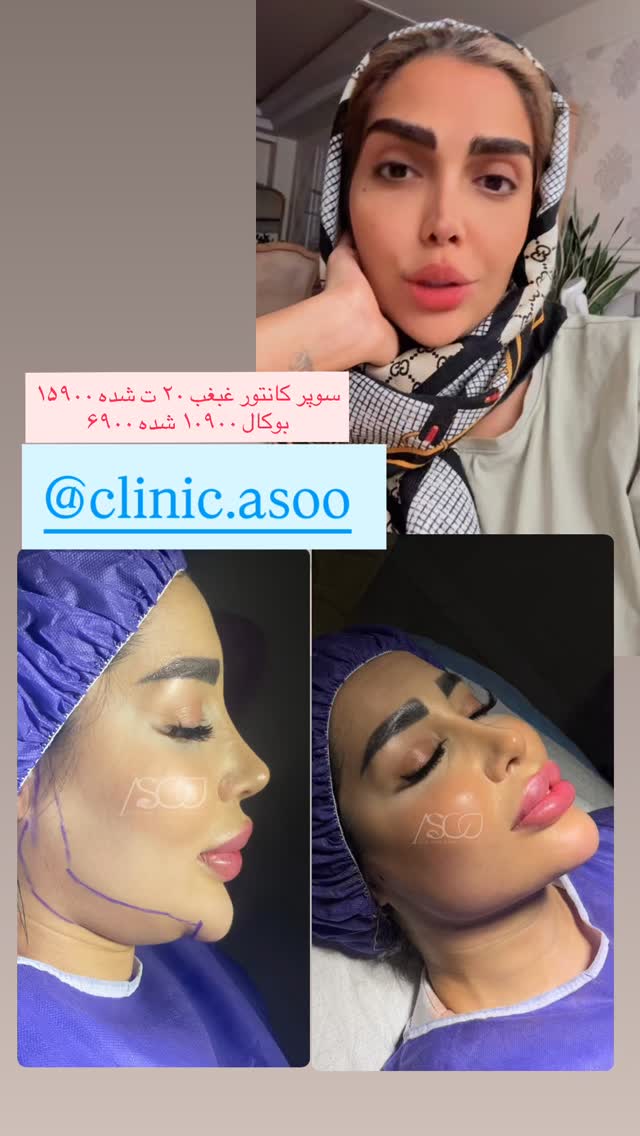  جدید ترین استوری اینستاگرام مهسا باصری