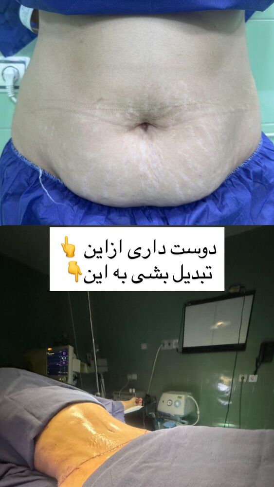  جدید ترین استوری اینستاگرام مهسا باصری