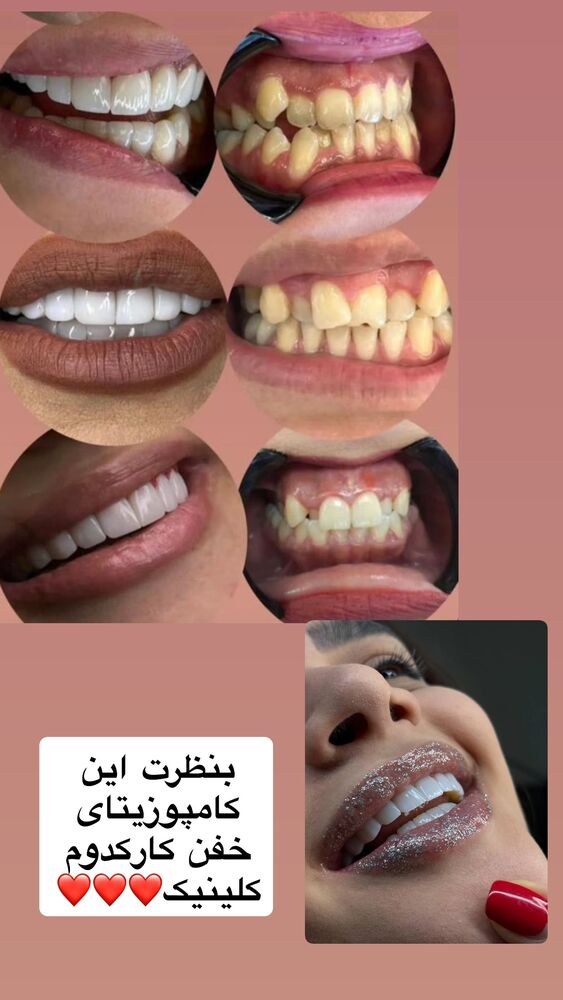  جدید ترین استوری اینستاگرام مهسا باصری