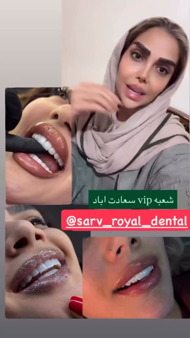  جدید ترین استوری اینستاگرام مهسا باصری