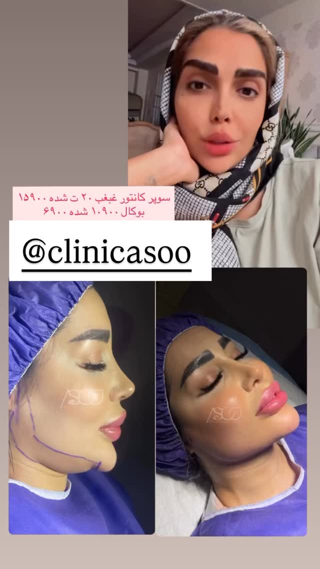  جدید ترین استوری اینستاگرام مهسا باصری