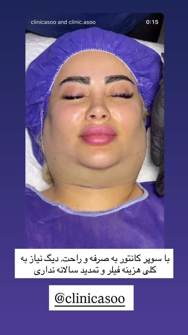  جدید ترین استوری اینستاگرام مهسا باصری