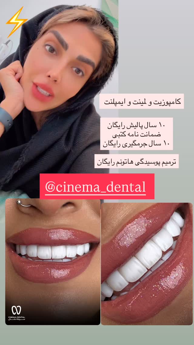  جدید ترین استوری اینستاگرام مهسا باصری