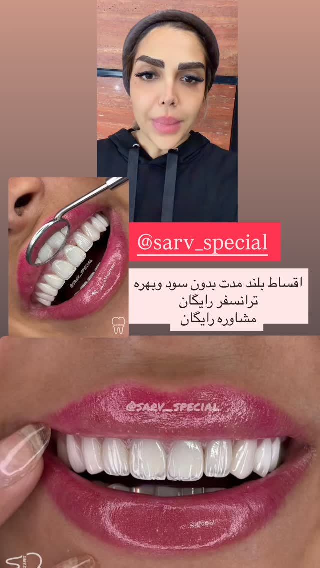  جدید ترین استوری اینستاگرام مهسا باصری