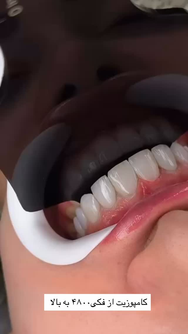  جدید ترین استوری اینستاگرام مهسا باصری