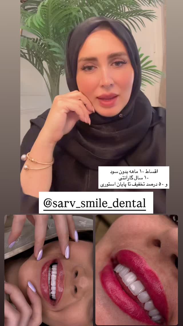  جدید ترین استوری اینستاگرام مهتاب گلی