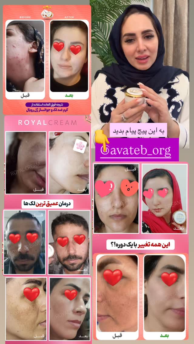  جدید ترین استوری اینستاگرام مهتاب گلی
