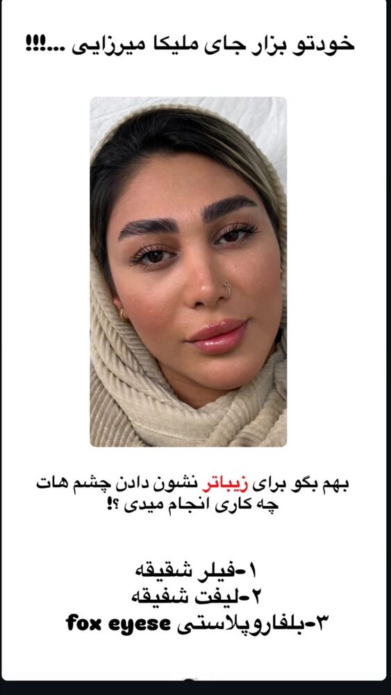  جدید ترین استوری اینستاگرام مهتاب چادری