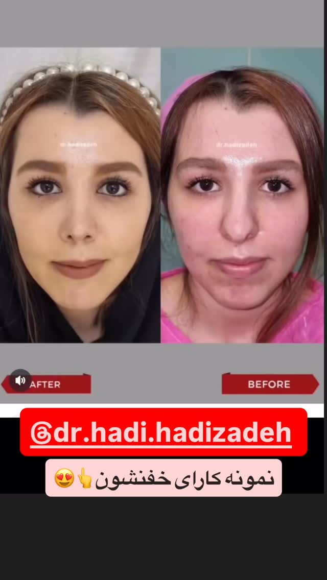  جدید ترین استوری اینستاگرام مهتاب چادری