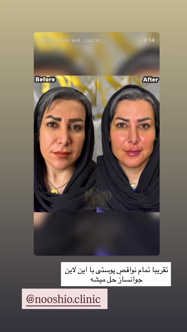 جدید ترین استوری اینستاگرام زهرا رسولی