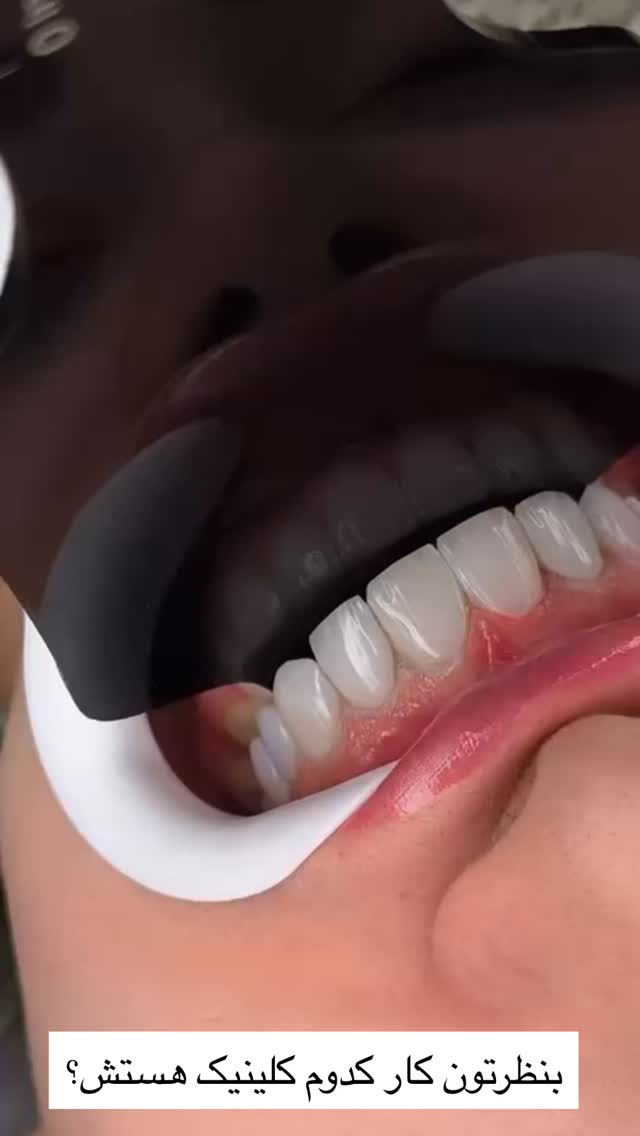  جدید ترین استوری اینستاگرام مرجان مرتضی