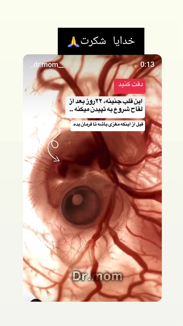  جدید ترین استوری اینستاگرام مرجان گلچین
