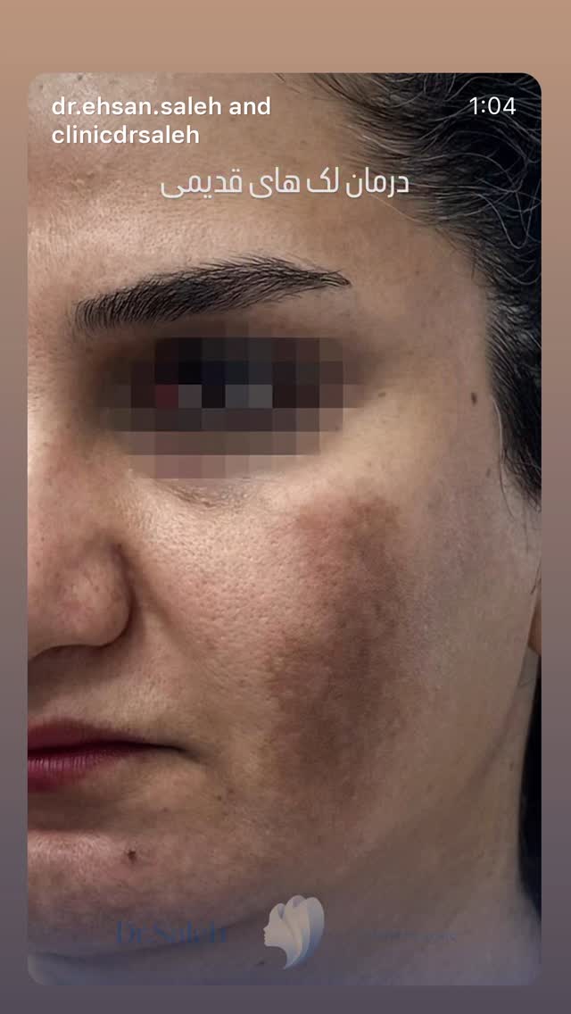  جدید ترین استوری اینستاگرام مرجان ماهینی