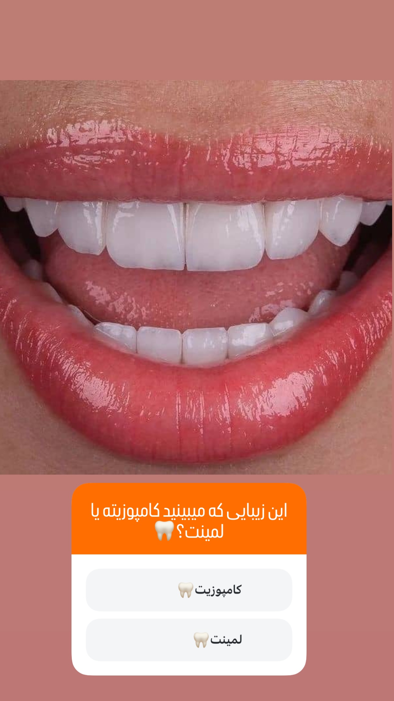  جدید ترین استوری اینستاگرام مریم سلطانی