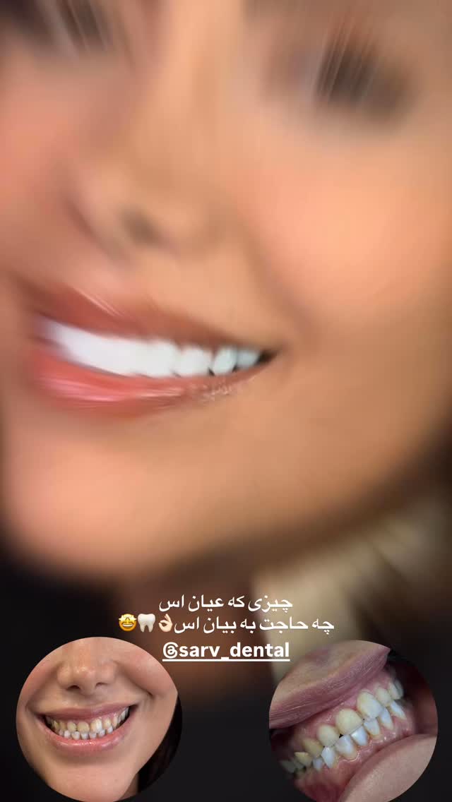  جدید ترین استوری اینستاگرام مریم سلطانی