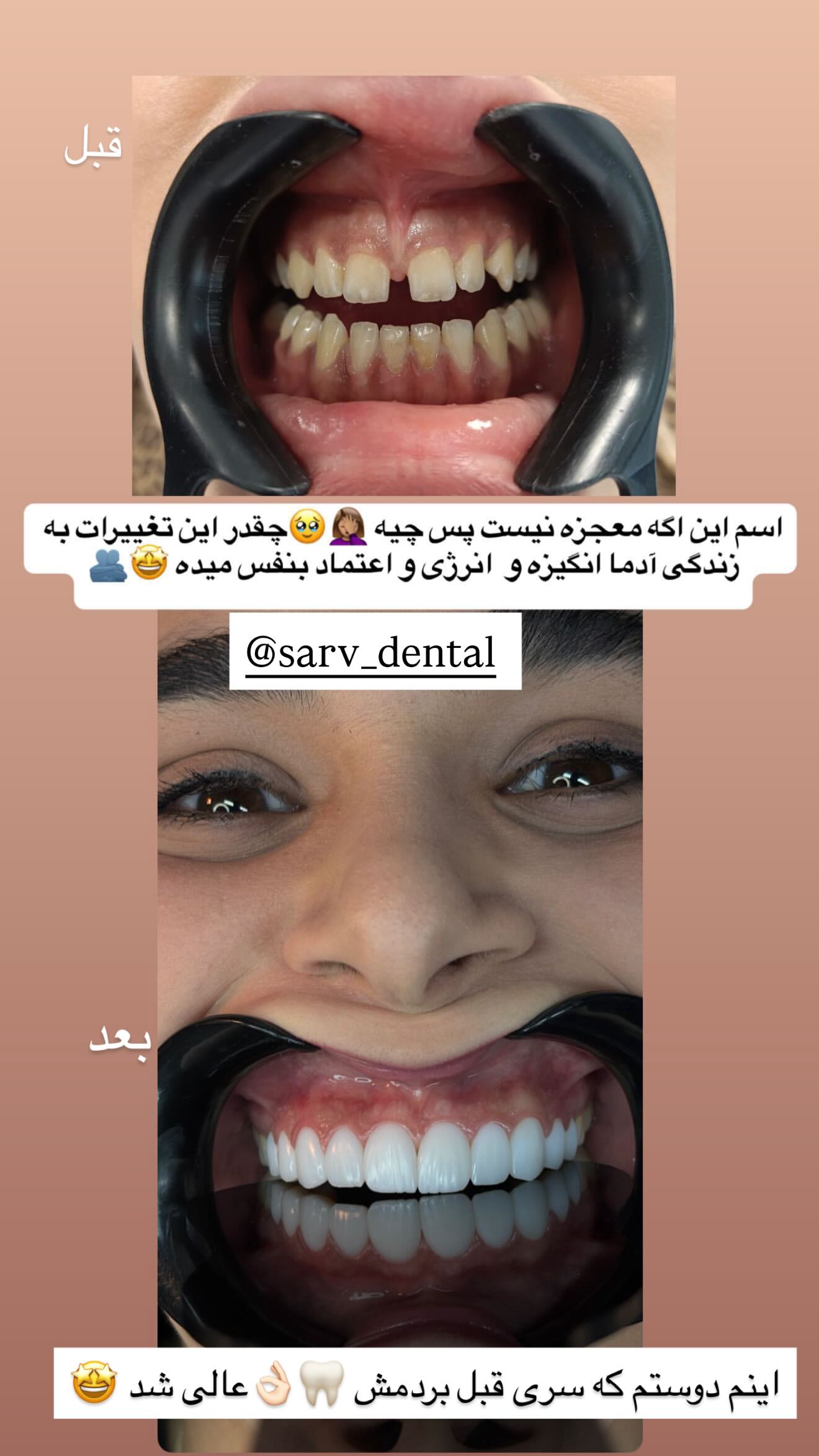  جدید ترین استوری اینستاگرام مریم سلطانی