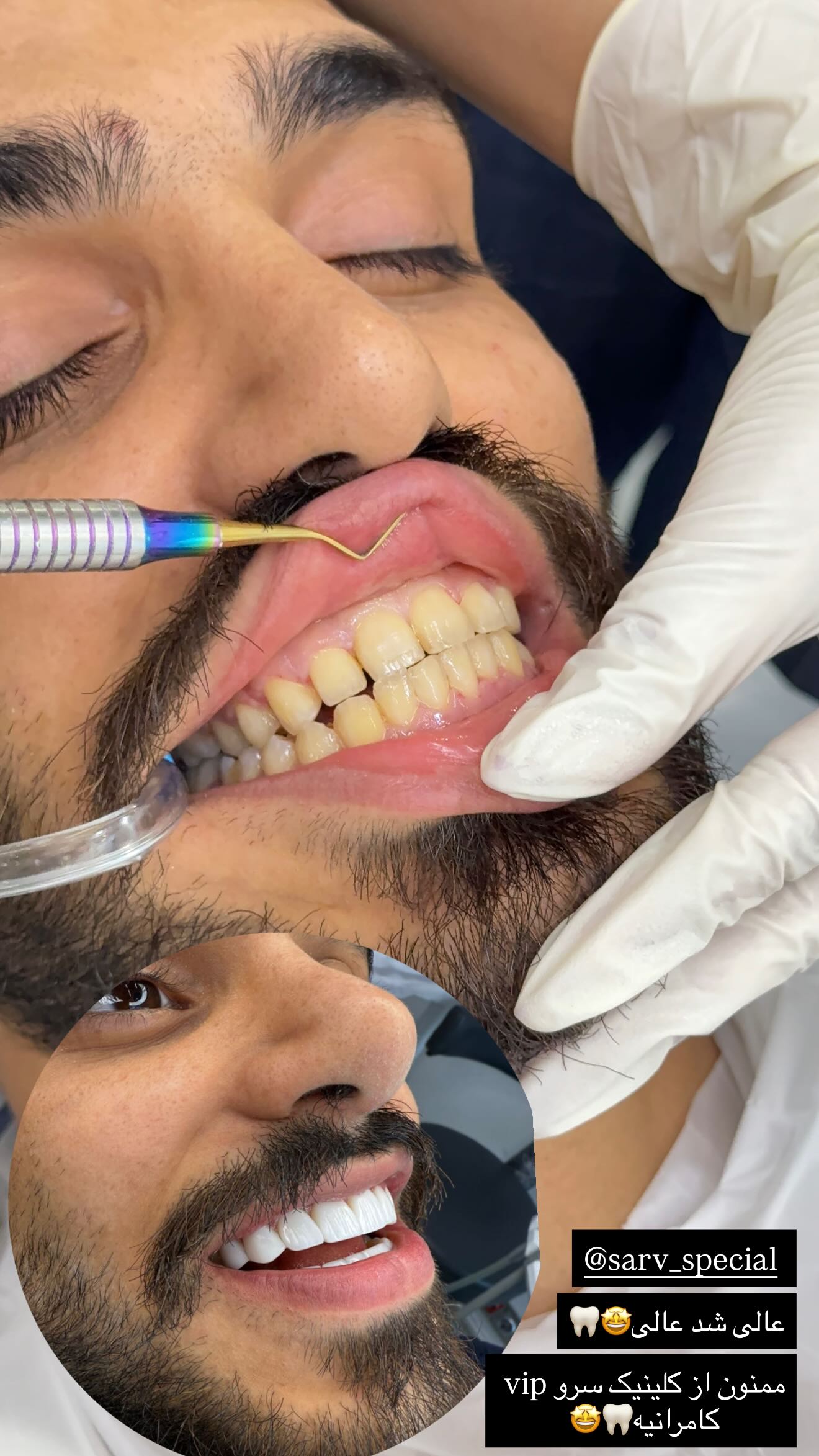  جدید ترین استوری اینستاگرام مریم سلطانی