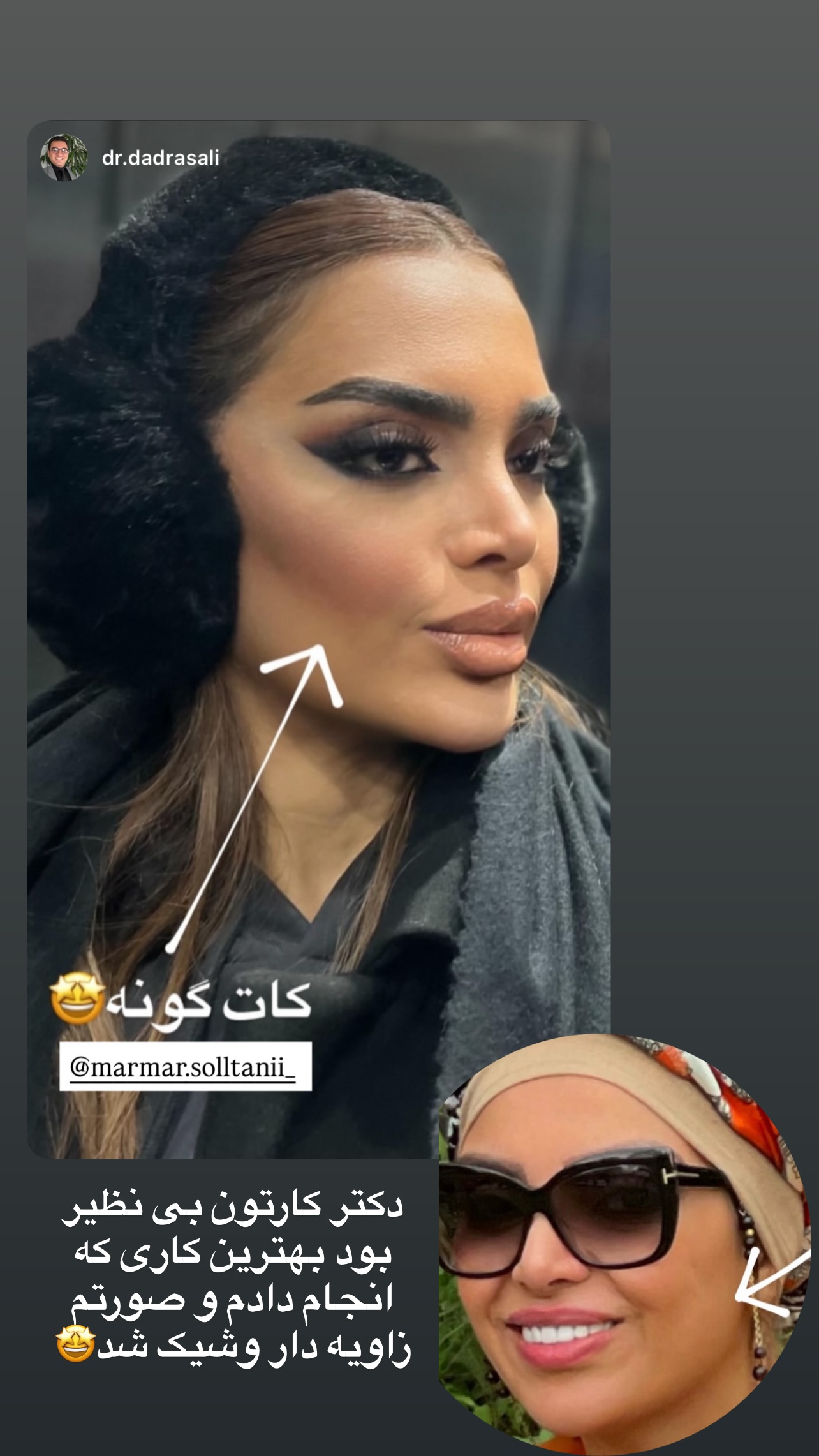  جدید ترین استوری اینستاگرام مریم سلطانی