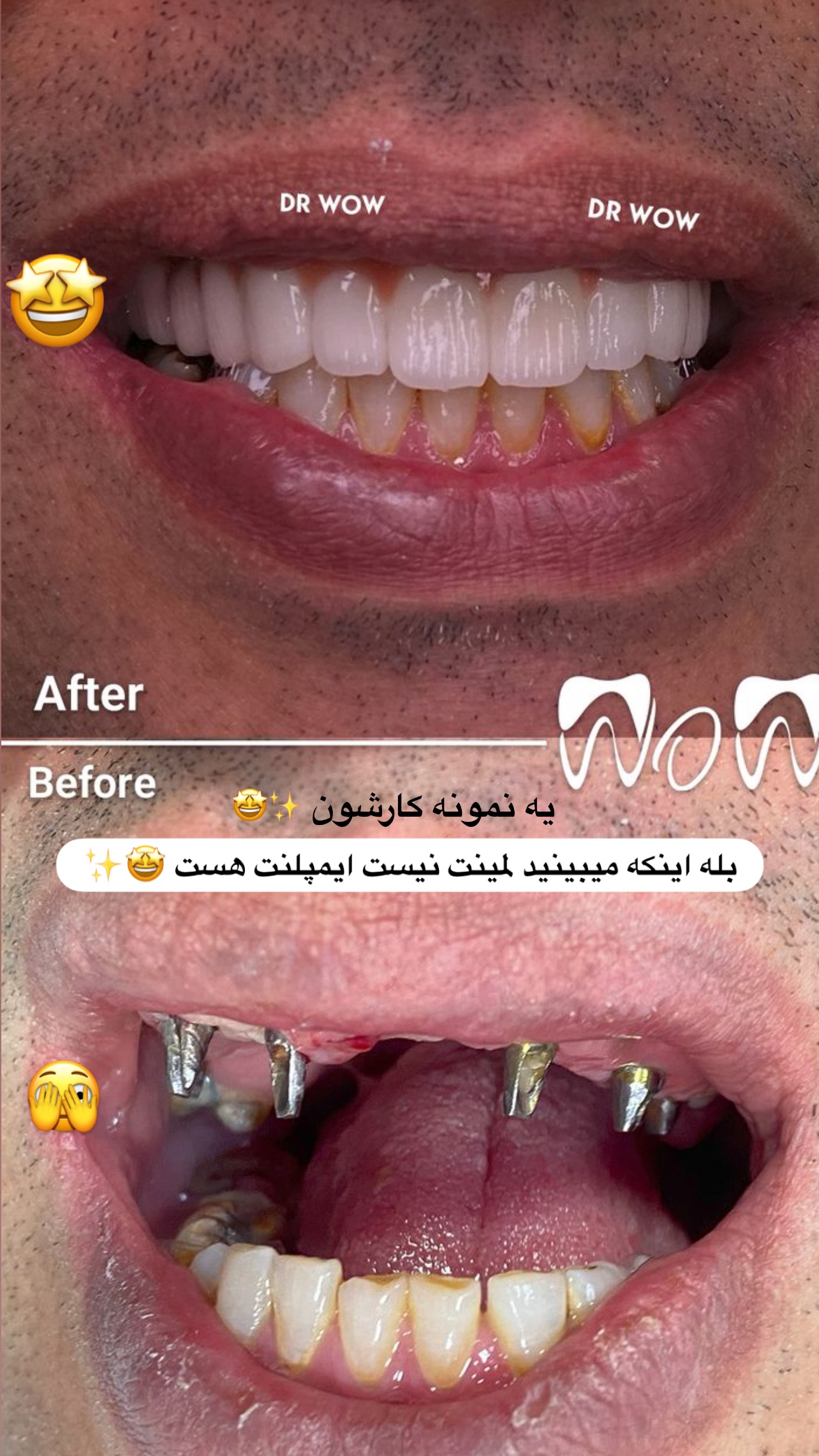  جدید ترین استوری اینستاگرام مریم سلطانی
