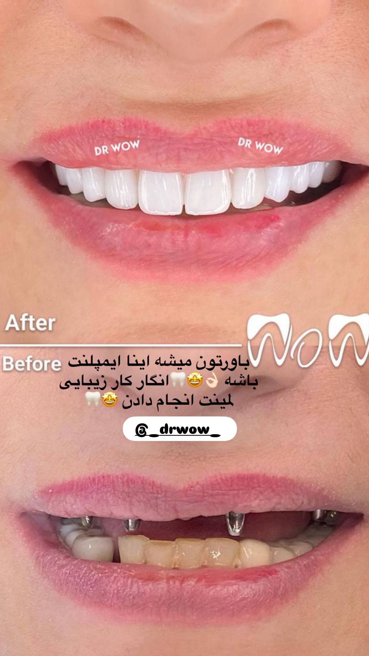  جدید ترین استوری اینستاگرام مریم سلطانی