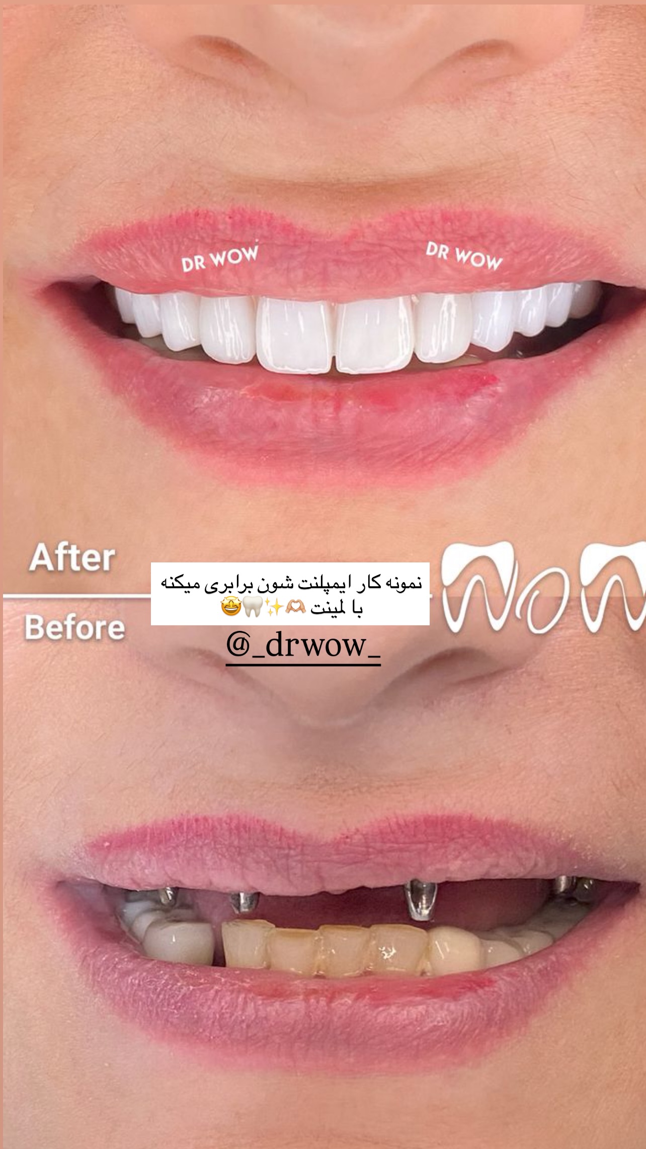  جدید ترین استوری اینستاگرام مریم سلطانی