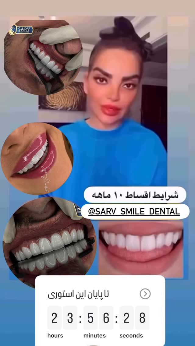  جدید ترین استوری اینستاگرام مریم سلطانی