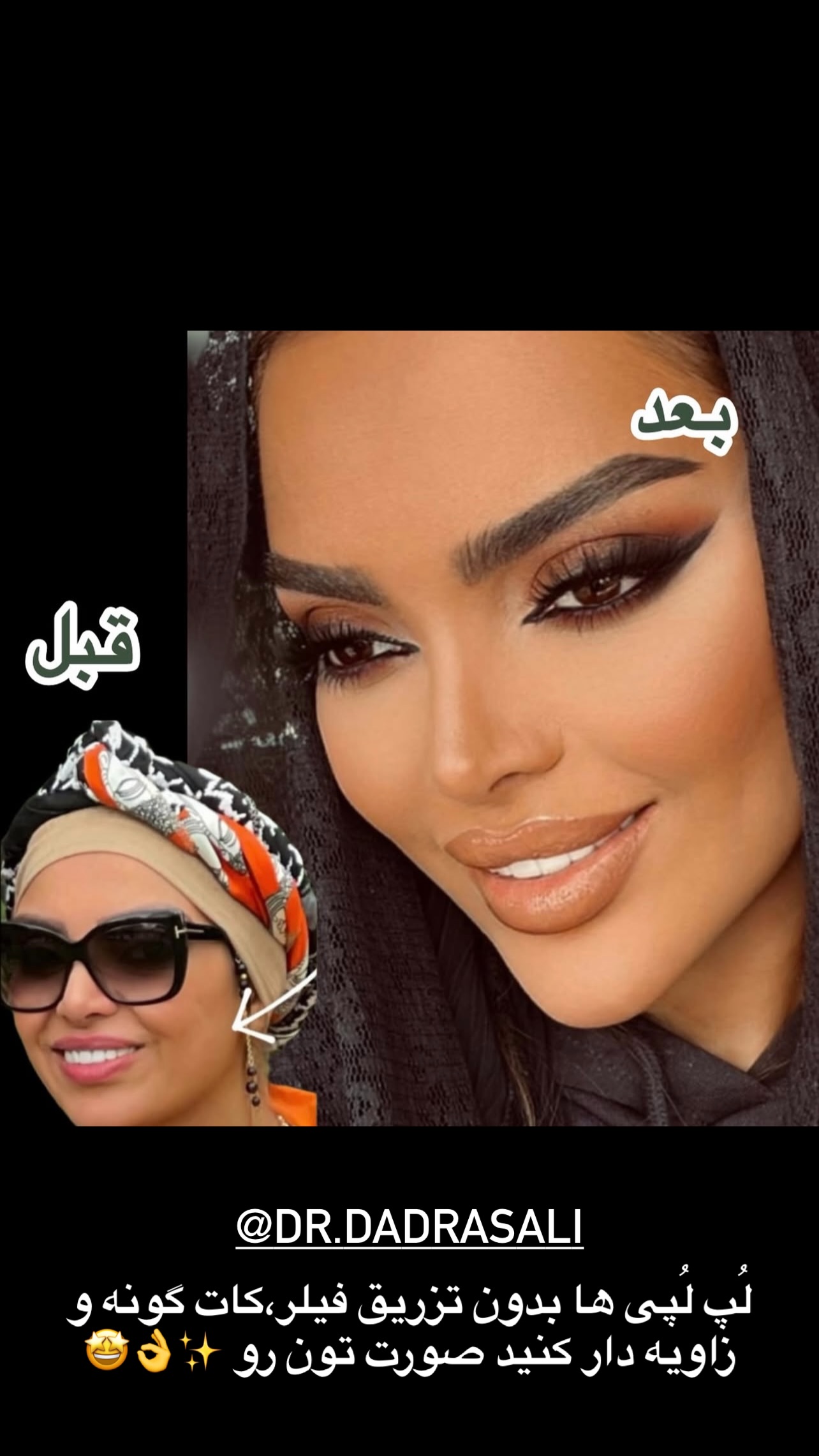  جدید ترین استوری اینستاگرام مرمر سلطانى