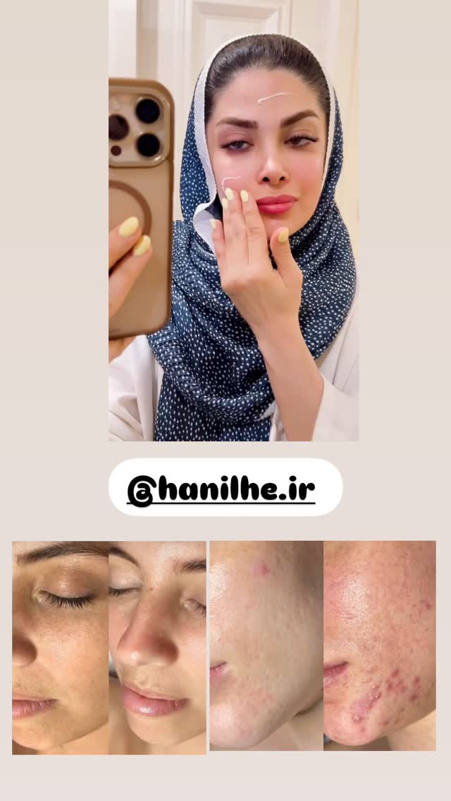  جدید ترین استوری اینستاگرام مائده