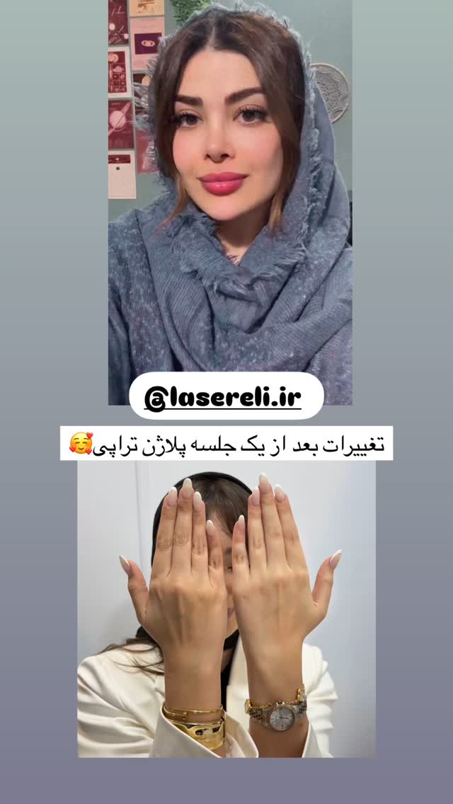  جدید ترین استوری اینستاگرام مائده