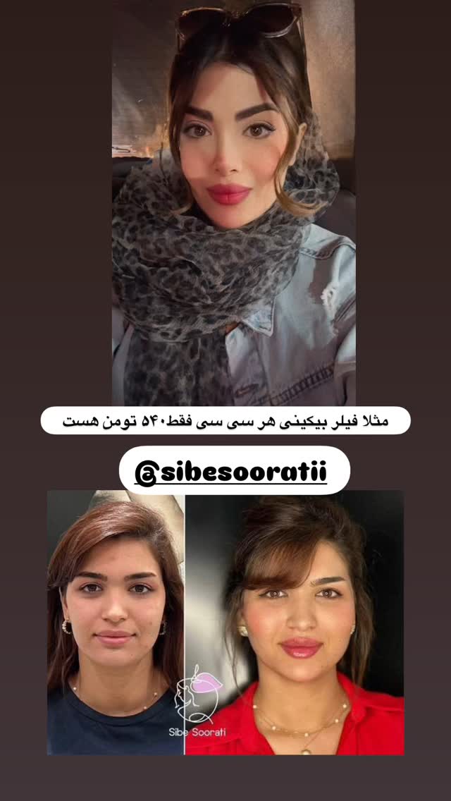  جدید ترین استوری اینستاگرام مائده