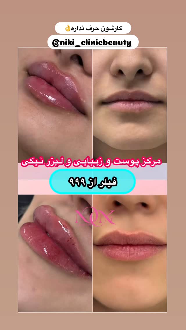  جدید ترین استوری اینستاگرام مائده