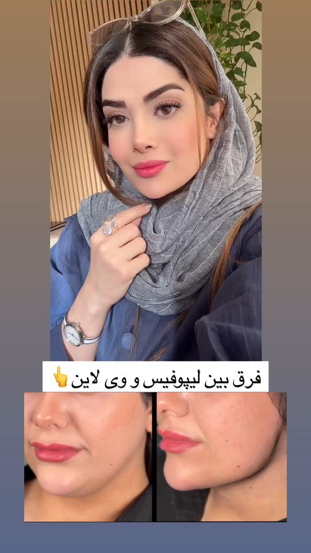  جدید ترین استوری اینستاگرام مائده