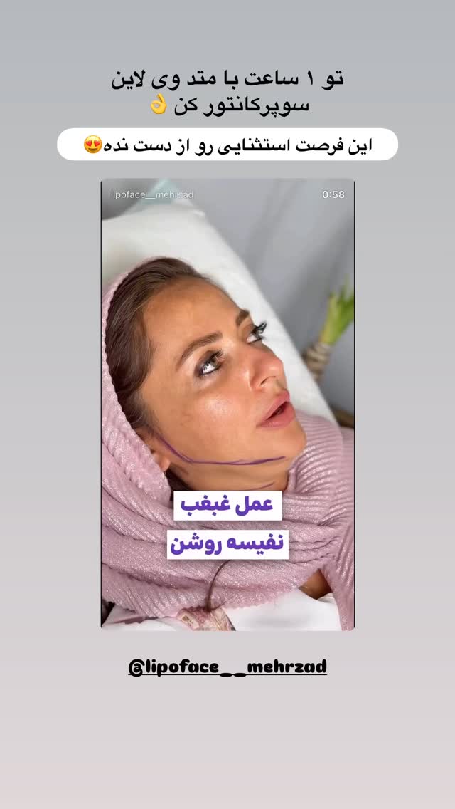  جدید ترین استوری اینستاگرام مائده