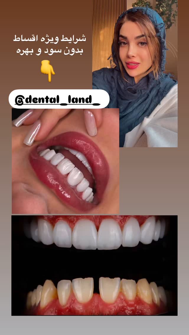  جدید ترین استوری اینستاگرام مائده
