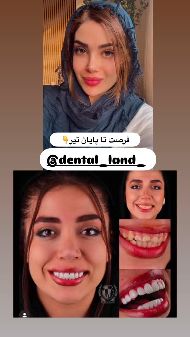  جدید ترین استوری اینستاگرام مائده