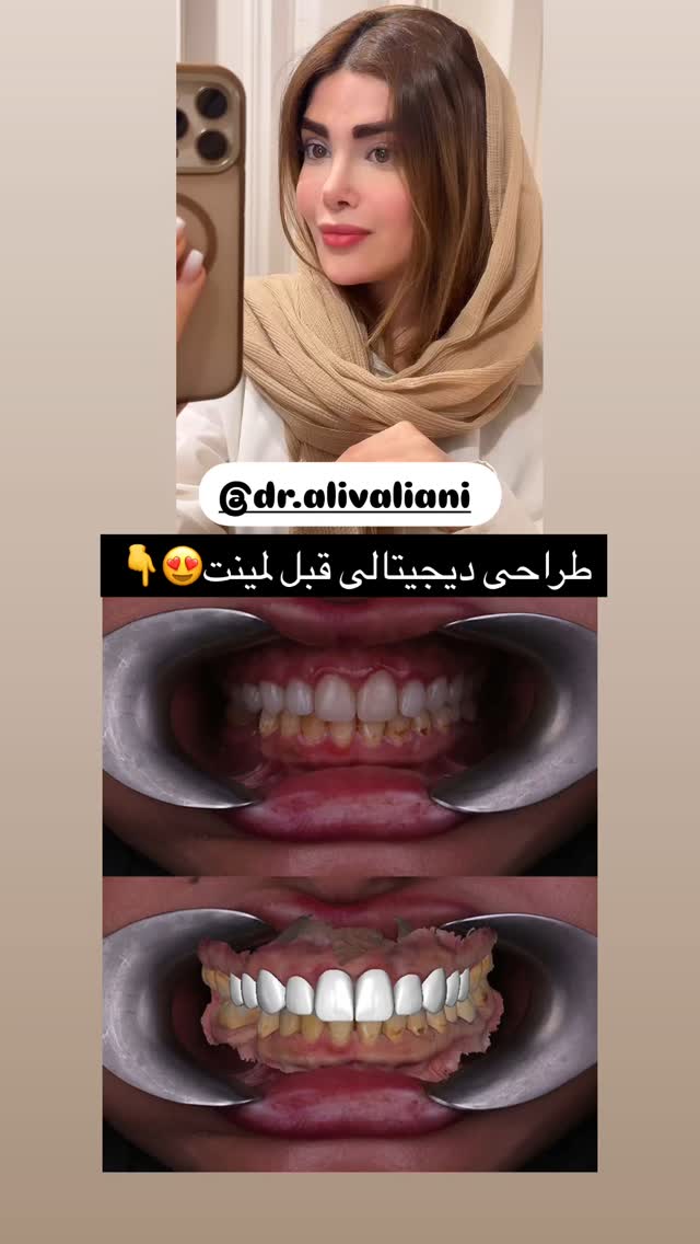  جدید ترین استوری اینستاگرام مائده