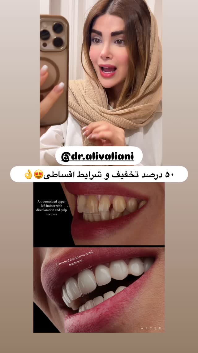  جدید ترین استوری اینستاگرام مائده