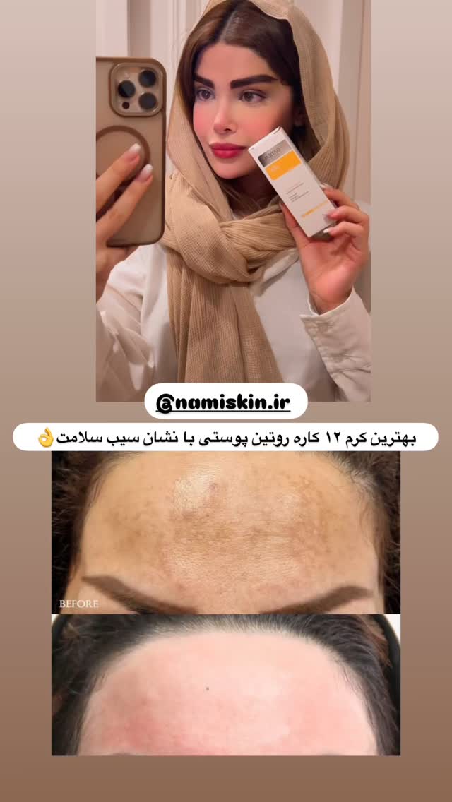 جدید ترین استوری اینستاگرام مائده