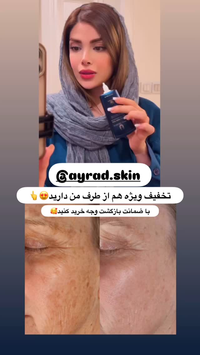  جدید ترین استوری اینستاگرام مائده