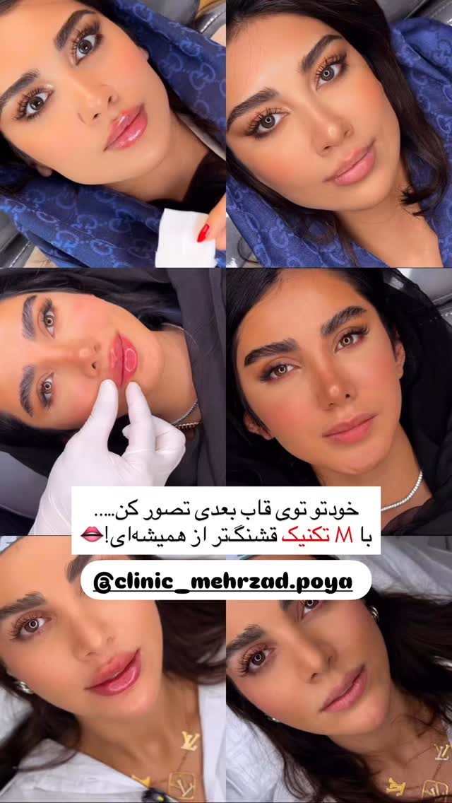  جدید ترین استوری اینستاگرام مائده