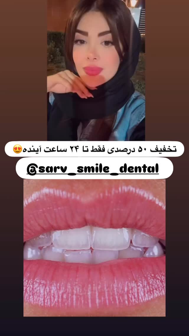  جدید ترین استوری اینستاگرام مائده