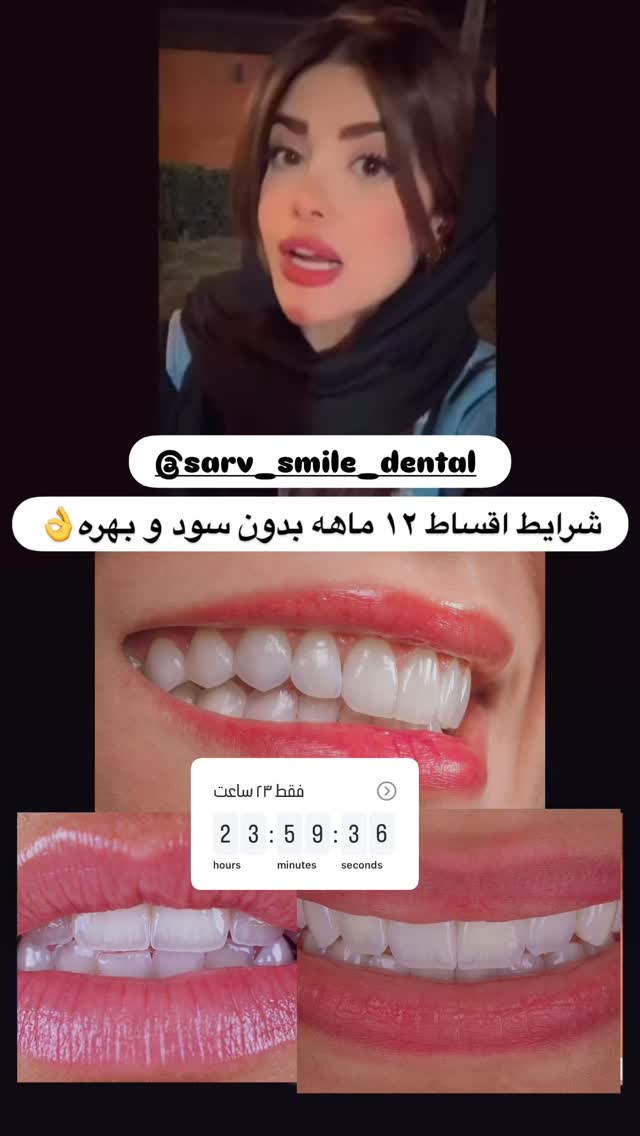  جدید ترین استوری اینستاگرام مائده