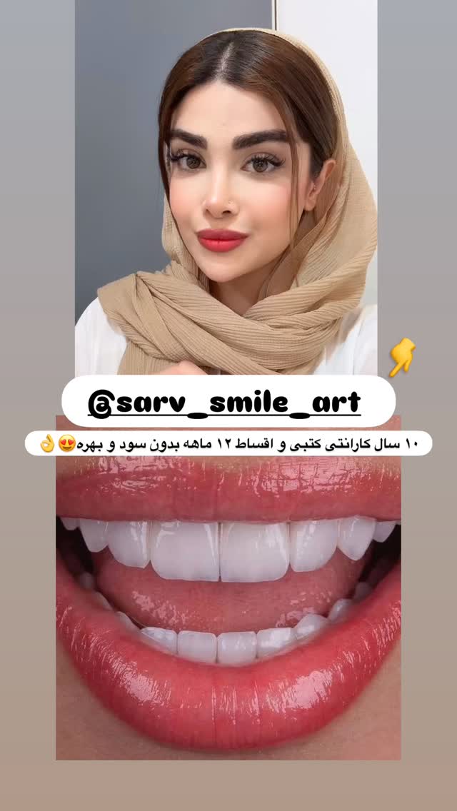  جدید ترین استوری اینستاگرام مائده