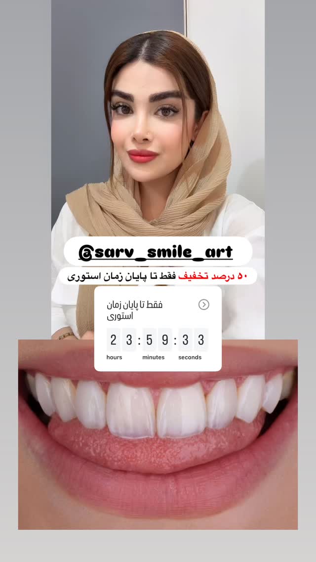  جدید ترین استوری اینستاگرام مائده