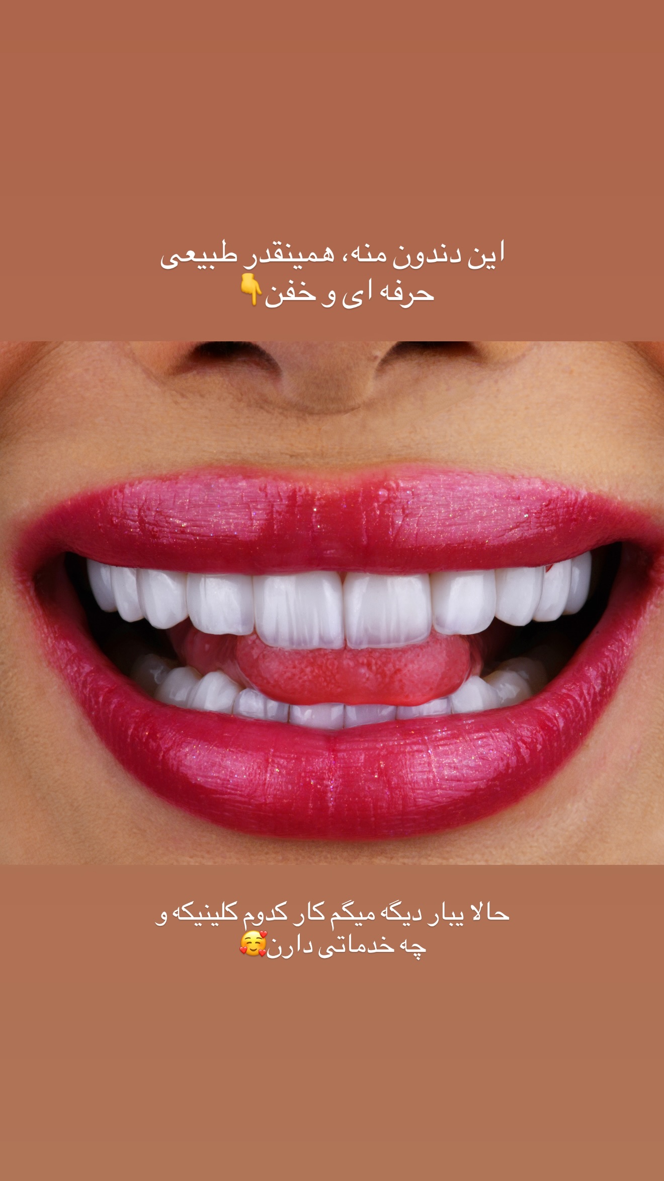  جدید ترین استوری اینستاگرام مائده