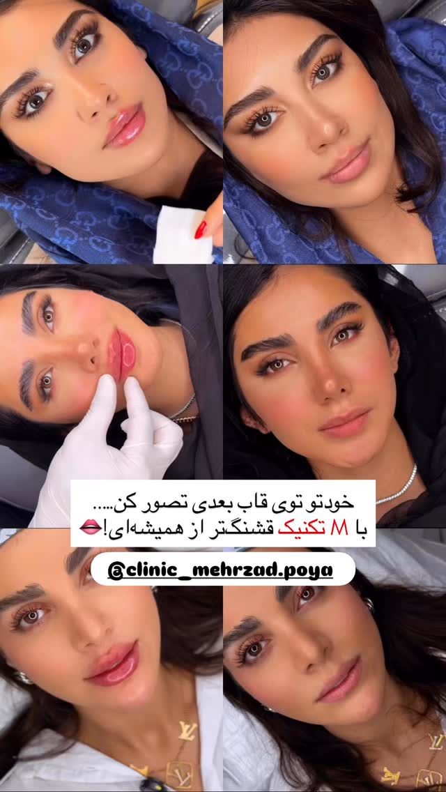  جدید ترین استوری اینستاگرام مائده